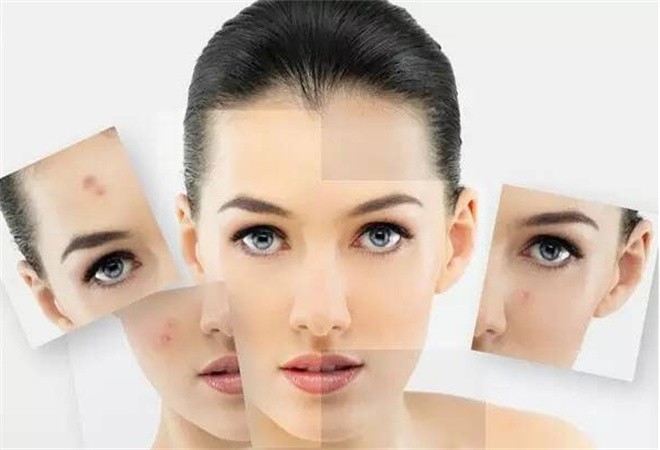 素傾顏祛痘祛斑加盟